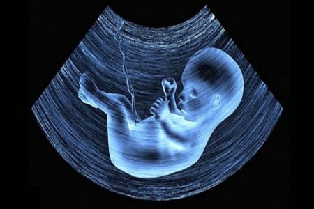 احکام شرعی | راه‌های جبران شرعی سقط عمدی چیست؟