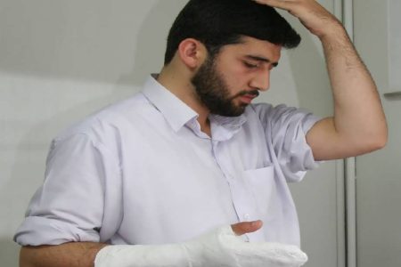 حکم وضوی جبیره در صورت پوشیده بودن بیشتر اعضای وضو چیست؟